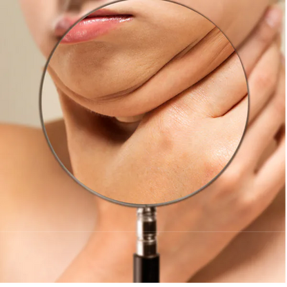 Visage | Elimina tu papada en SOLO 30 MINUTOS al día!